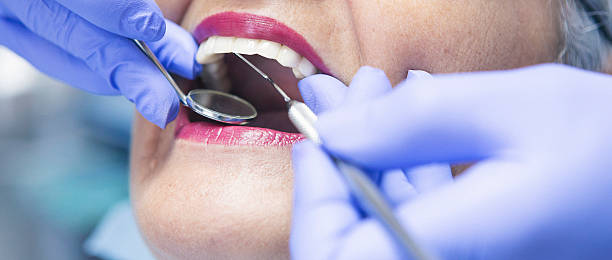Best Emergency Dentist for Lost Fillings or Crowns in Black Creek, WI