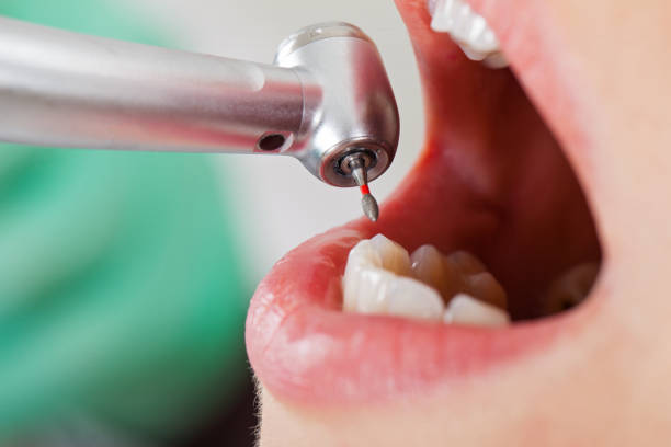 Best Emergency Root Canal Treatment in Black Creek, WI